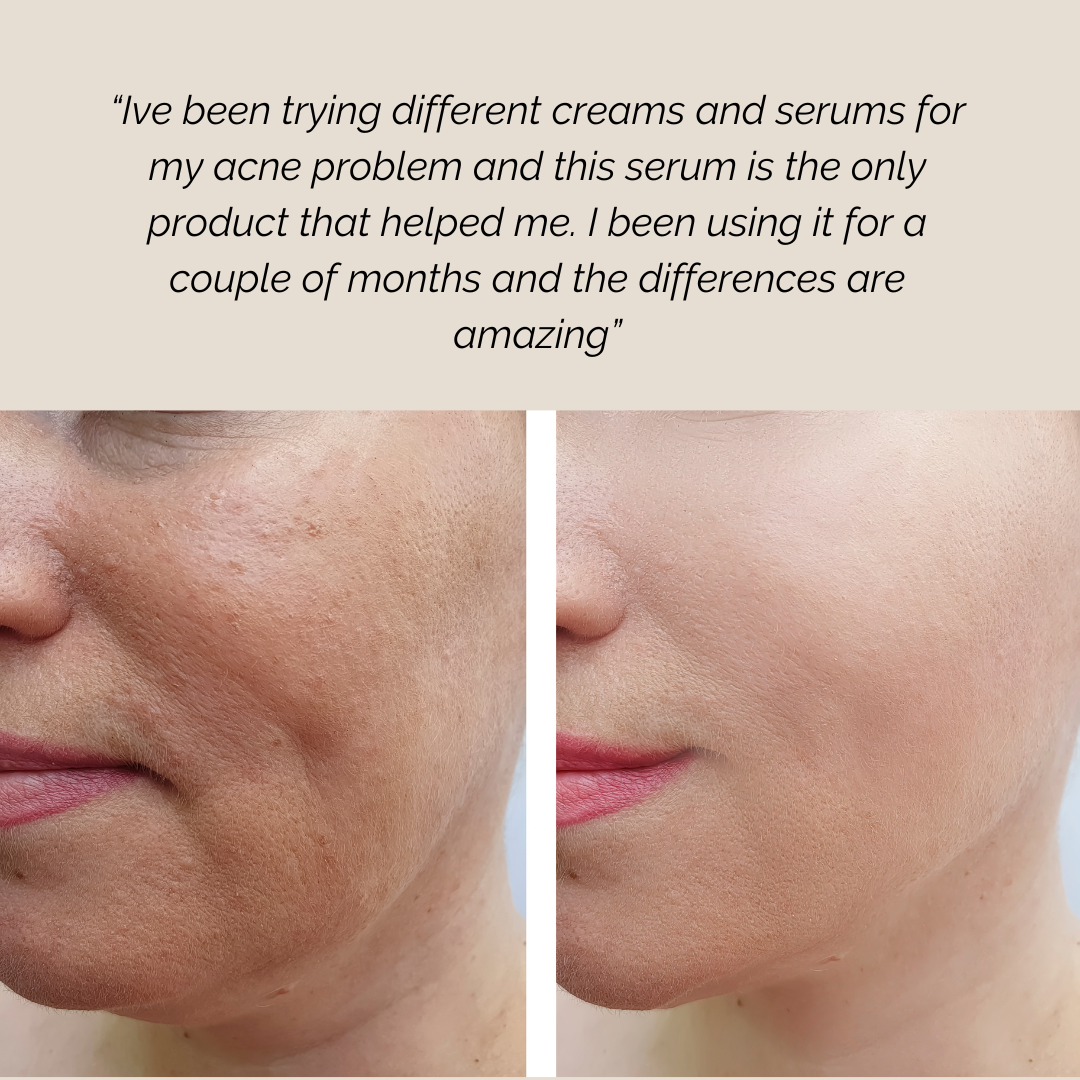 Before and after using Repairative Face Serum, showing smoother, hydrated, and radiant skin